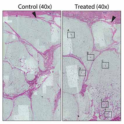 -Histology-TS-Damage-Fat